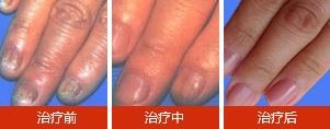 康复案例